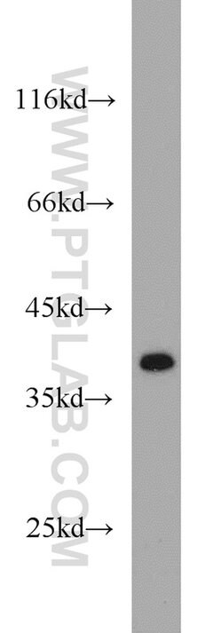 IkB alpha Rabbit anti-Human, Mouse, Porcine, Polyclonal, Proteintech 150