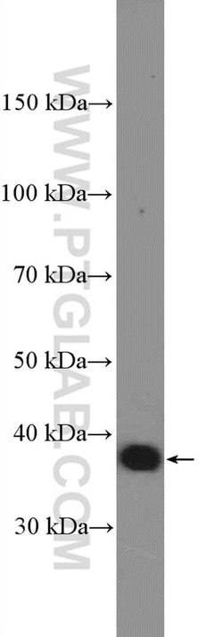 IkB alpha Rabbit anti-Human, Mouse, Porcine, Polyclonal, Proteintech 150