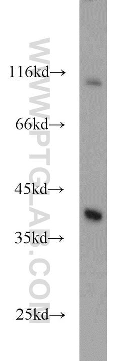 IkB alpha Rabbit anti-Human, Mouse, Porcine, Polyclonal, Proteintech 150