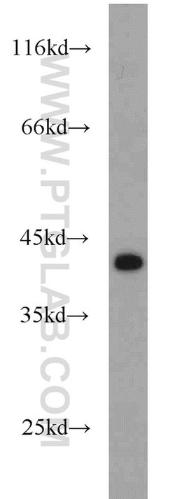 IkB alpha Rabbit anti-Human, Mouse, Porcine, Polyclonal, Proteintech 150