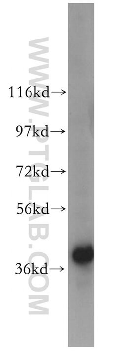 IkB alpha Rabbit anti-Human, Mouse, Porcine, Polyclonal, Proteintech 150