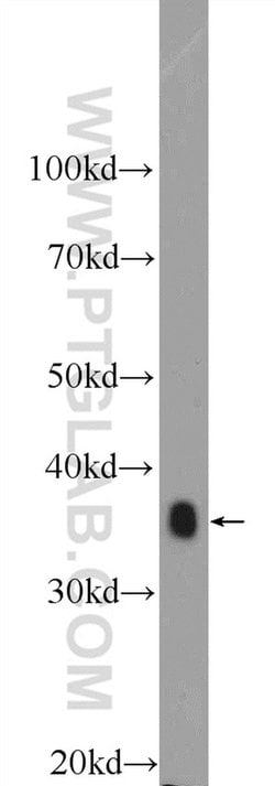 IkB alpha Rabbit anti-Human, Mouse, Porcine, Polyclonal, Proteintech 150