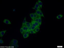 TRAPB/SSR2 Rabbit anti-Human, Mouse, Rat, Polyclonal, Proteintech:Antibodies:Primary