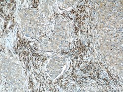 TRAPB/SSR2 Rabbit anti-Human, Mouse, Rat, Polyclonal, Proteintech:Antibodies:Primary