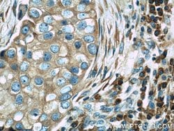 TRAPB/SSR2 Rabbit anti-Human, Mouse, Rat, Polyclonal, Proteintech:Antibodies:Primary