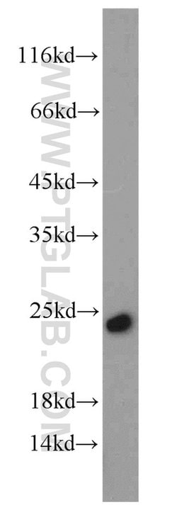 TRAPB/SSR2 Rabbit anti-Human, Mouse, Rat, Polyclonal, Proteintech:Antibodies:Primary