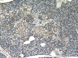 TRAPB/SSR2 Rabbit anti-Human, Mouse, Rat, Polyclonal, Proteintech:Antibodies:Primary