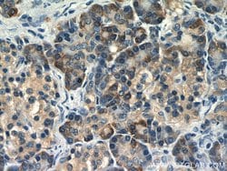 TRAPB/SSR2 Rabbit anti-Human, Mouse, Rat, Polyclonal, Proteintech:Antibodies:Primary