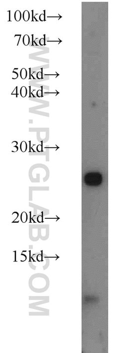 TRAPB/SSR2 Rabbit anti-Human, Mouse, Rat, Polyclonal, Proteintech:Antibodies:Primary
