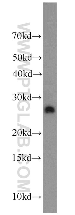 TRAPB/SSR2 Rabbit anti-Human, Mouse, Rat, Polyclonal, Proteintech:Antibodies:Primary