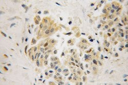 MAGEC2 Rabbit anti-Human, Polyclonal, Proteintech 150 &mu;L; Unconjugated:Antibodies,