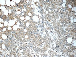 MAGEC2 Rabbit anti-Human, Polyclonal, Proteintech 150 &mu;L; Unconjugated:Antibodies,