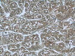 MAGEC2 Rabbit anti-Human, Polyclonal, Proteintech 150 &mu;L; Unconjugated:Antibodies,
