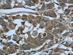 MAGEC2 Rabbit anti-Human, Polyclonal, Proteintech 150 &mu;L; Unconjugated:Antibodies,