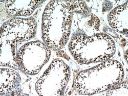 MAGEC2 Rabbit anti-Human, Polyclonal, Proteintech 150 &mu;L; Unconjugated:Antibodies,