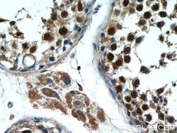 MAGEC2 Rabbit anti-Human, Polyclonal, Proteintech 150 &mu;L; Unconjugated:Antibodies,