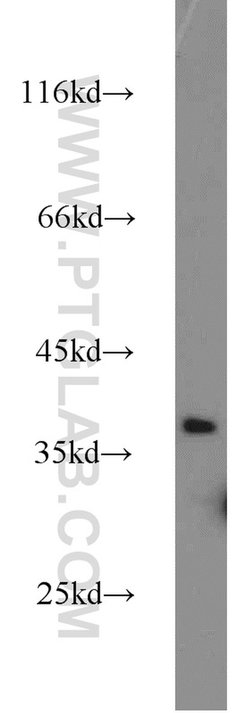 MAGEC2 Rabbit anti-Human, Polyclonal, Proteintech 150 &mu;L; Unconjugated:Antibodies,