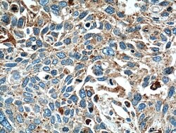 LGALS3BP Rabbit anti-Human, Polyclonal, Proteintech:Antibodies:Primary
