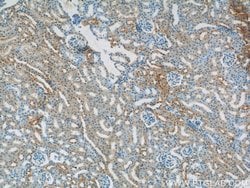 CYPC Rabbit anti-Human, Mouse, Rat, Polyclonal, Proteintech:Antibodies:Primary
