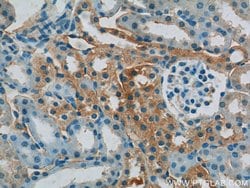 CYPC Rabbit anti-Human, Mouse, Rat, Polyclonal, Proteintech:Antibodies:Primary