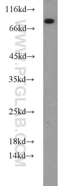 CYPC Rabbit anti-Human, Mouse, Rat, Polyclonal, Proteintech:Antibodies:Primary