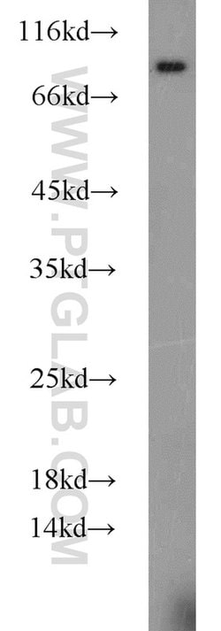 CYPC Rabbit anti-Human, Mouse, Rat, Polyclonal, Proteintech:Antibodies:Primary