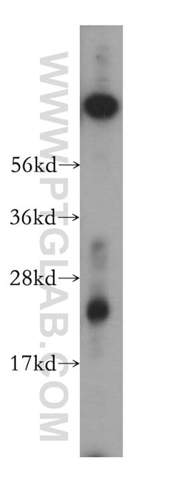 CYPC Rabbit anti-Human, Mouse, Rat, Polyclonal, Proteintech:Antibodies:Primary