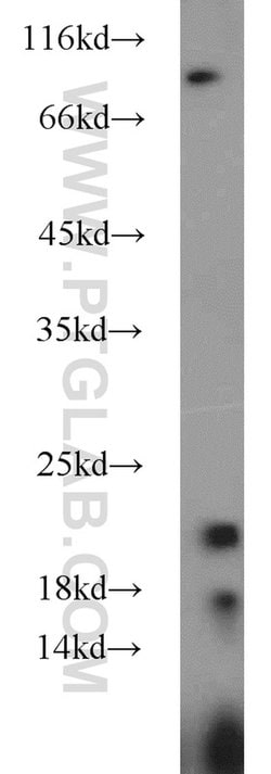 CYPC Rabbit anti-Human, Mouse, Rat, Polyclonal, Proteintech:Antibodies:Primary