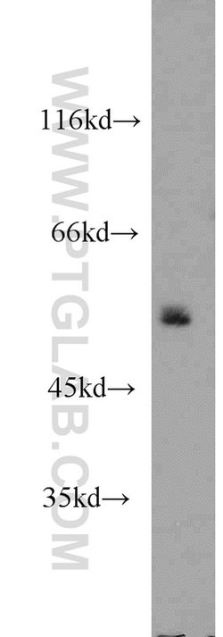 POLD2 Rabbit anti-Human, Mouse, Rat, Polyclonal, Proteintech:Antibodies:Primary