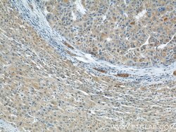 CCM3/PDCD10 Rabbit anti-Human, Mouse, Rat, Polyclonal, Proteintech:Antibodies:Primary