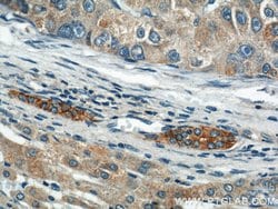 CCM3/PDCD10 Rabbit anti-Human, Mouse, Rat, Polyclonal, Proteintech:Antibodies:Primary