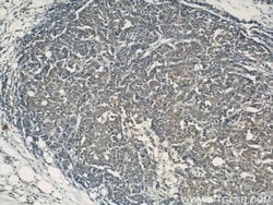 CCM3/PDCD10 Rabbit anti-Human, Mouse, Rat, Polyclonal, Proteintech:Antibodies:Primary