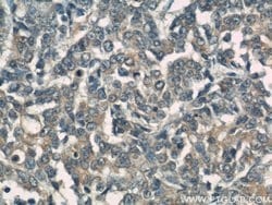 CCM3/PDCD10 Rabbit anti-Human, Mouse, Rat, Polyclonal, Proteintech:Antibodies:Primary