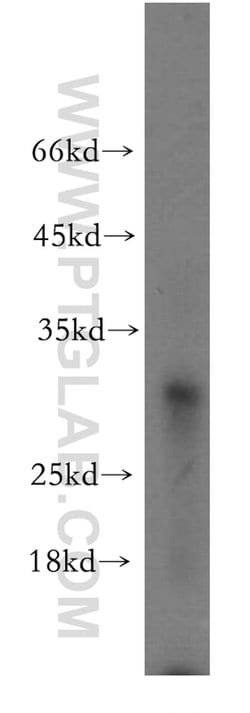 CCM3/PDCD10 Rabbit anti-Human, Mouse, Rat, Polyclonal, Proteintech:Antibodies:Primary