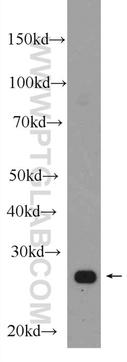 CCM3/PDCD10 Rabbit anti-Human, Mouse, Rat, Polyclonal, Proteintech:Antibodies:Primary
