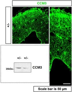 CCM3/PDCD10 Rabbit anti-Human, Mouse, Rat, Polyclonal, Proteintech:Antibodies:Primary