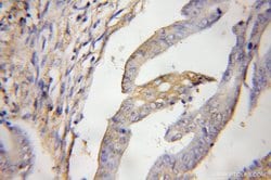 CCM3/PDCD10 Rabbit anti-Human, Mouse, Rat, Polyclonal, Proteintech:Antibodies:Primary