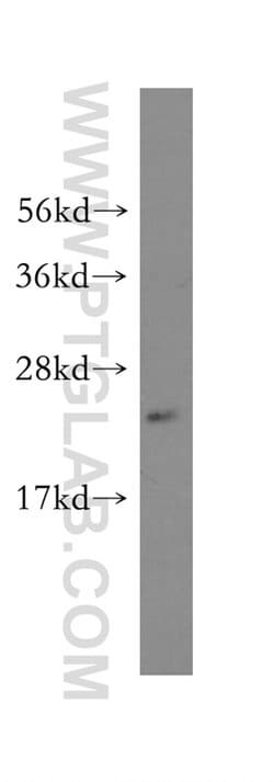 CCM3/PDCD10 Rabbit anti-Human, Mouse, Rat, Polyclonal, Proteintech:Antibodies:Primary