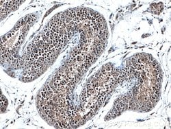 PLK1 Rabbit anti-Human, Mouse, Rat, Polyclonal, Proteintech:Antibodies:Primary