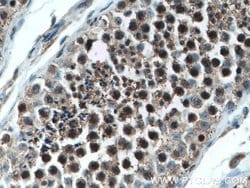 PLK1 Rabbit anti-Human, Mouse, Rat, Polyclonal, Proteintech:Antibodies:Primary