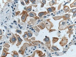 GPRC5A/RAI3 Rabbit anti-Human, Polyclonal, Proteintech:Antibodies:Primary