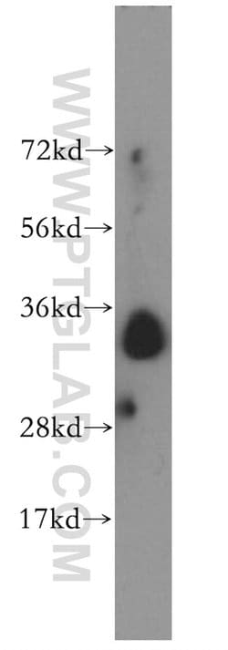 Stanniocalcin 2 Rabbit anti-Human, Polyclonal, Proteintech:Antibodies:Primary