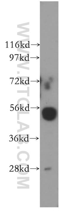 Cathepsin H Rabbit anti-Human, Mouse, Rat, Polyclonal, Proteintech 150