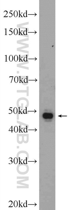 Cathepsin H Rabbit anti-Human, Mouse, Rat, Polyclonal, Proteintech 150