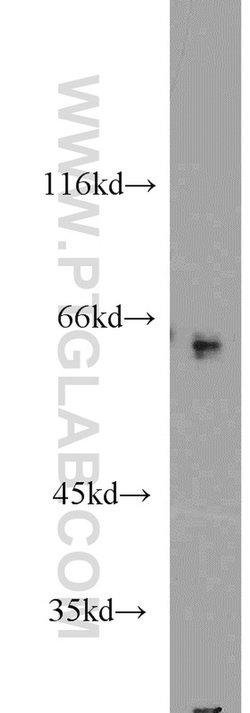 CRMP1 Rabbit anti-Human, Mouse, Rat, Polyclonal, Proteintech 150 &mu;L;