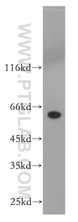 CRMP1 Rabbit anti-Human, Mouse, Rat, Polyclonal, Proteintech 150 &mu;L;