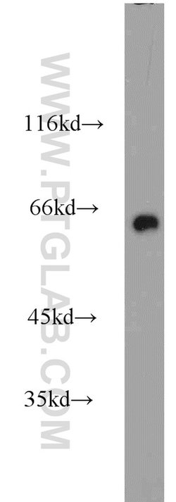 Proteintech Group Inc CRMP1 Rabbit anti-Human, Mouse, Rat, Polyclonal, Proteintech