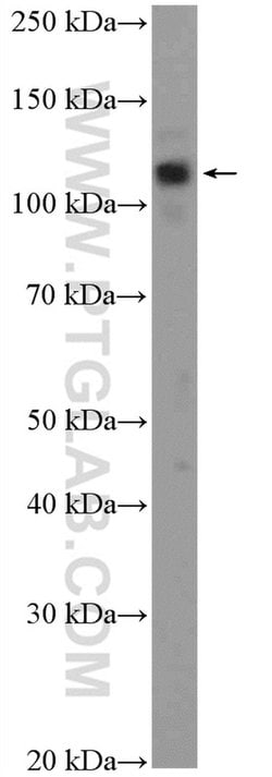 EIF3B Rabbit anti-Human, Mouse, Rat, Polyclonal, Proteintech 150 &mu;L;