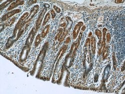 PPP2R4 Rabbit anti-Human, Mouse, Rat, Polyclonal, Proteintech 150 &mu;L;