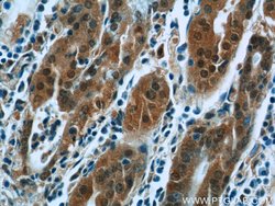 PPP2R4 Rabbit anti-Human, Mouse, Rat, Polyclonal, Proteintech 150 &mu;L;